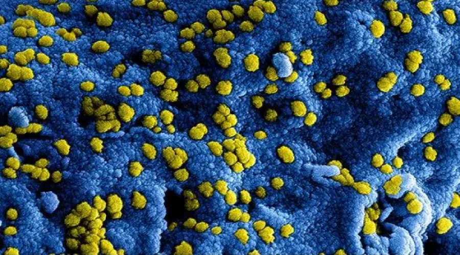 corona-1 New Coronavirus Case In Ontario