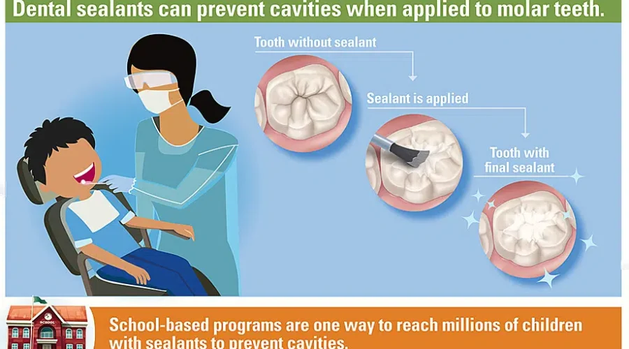 41673823762_d1ac9b442e_b-1 Health Unit Express Importance Of Proper Dental Care