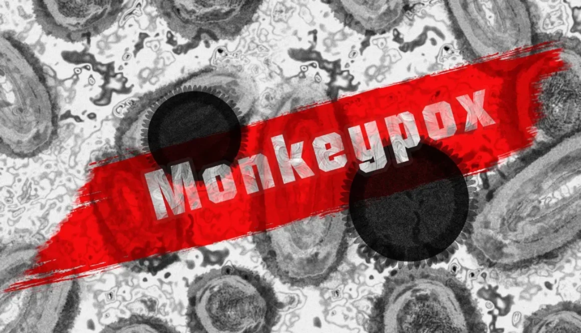 monkey-pox-7217582-1920