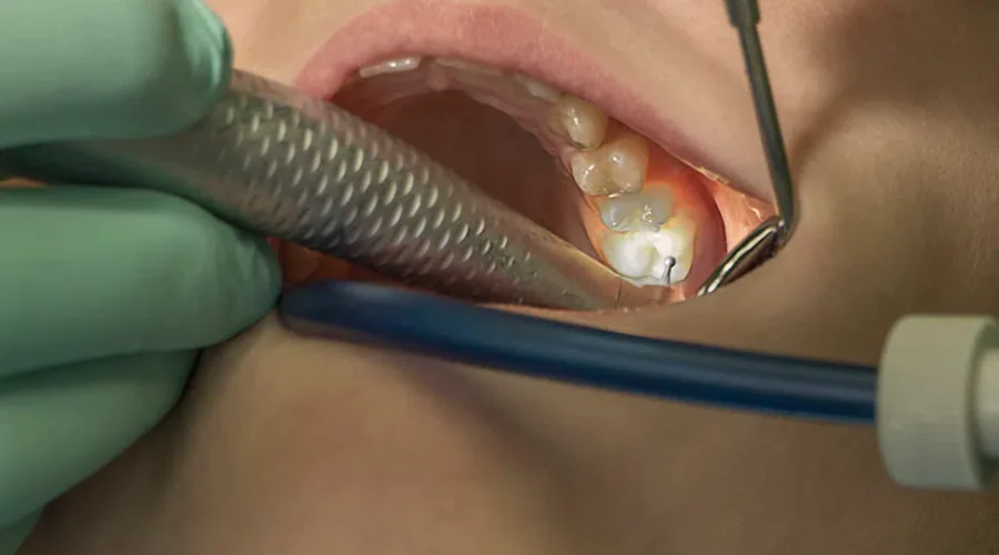 21081504314_d4dd8907a0_b-1 Dentists seek provincial support