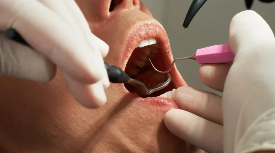 JiBssiZVPZA-scaled-1 National dental plan details revealed