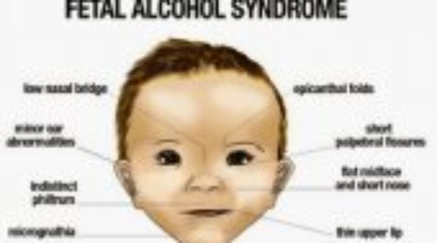 FASD Awareness Across District