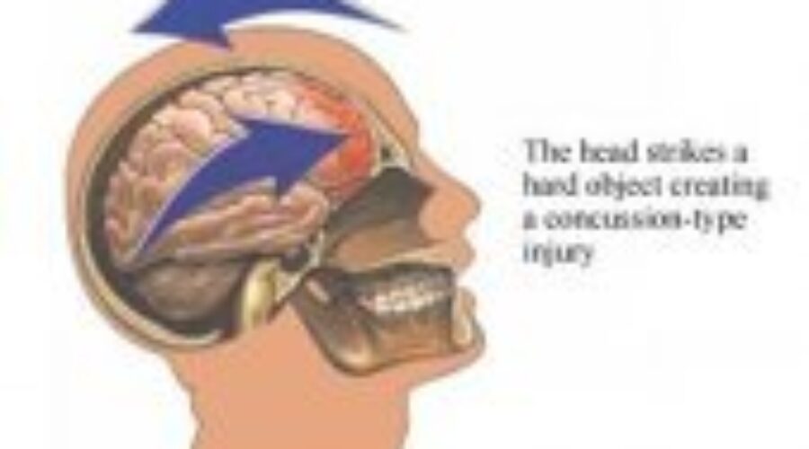 Preperations For Head Injury Symposium