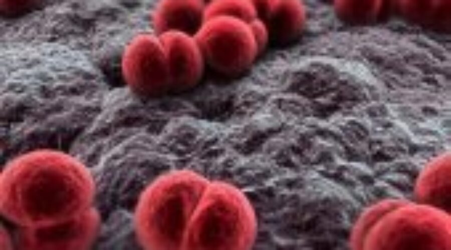 Deadly Infection Hits Aboriginal Communities
