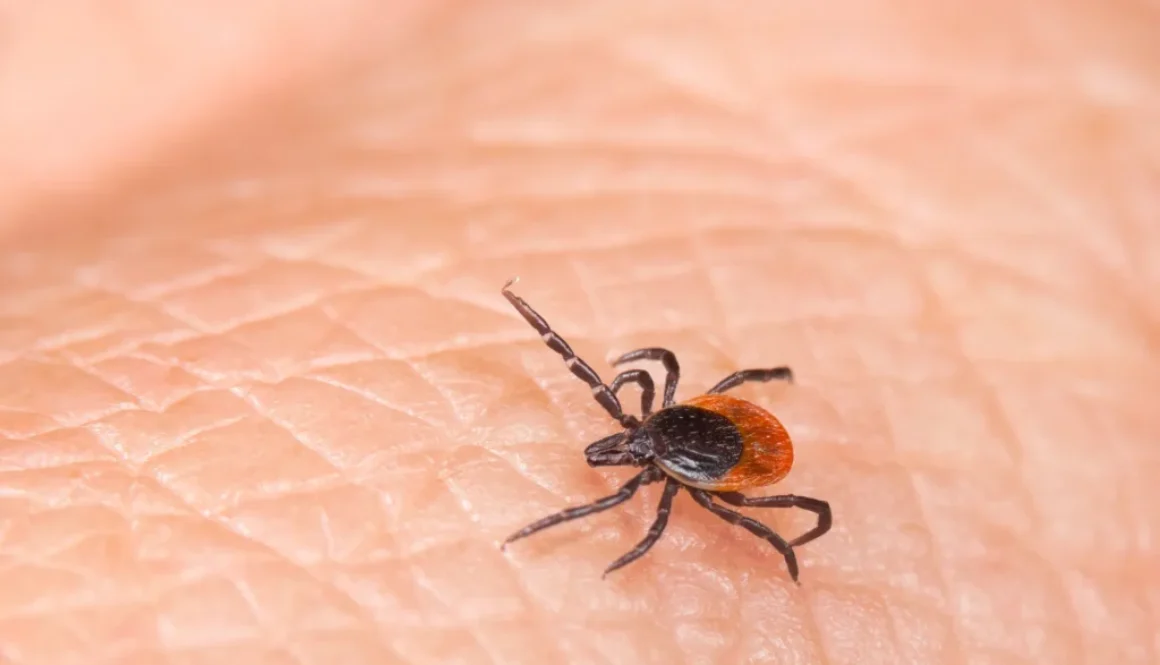 Parasite castor bean, black-legged or deer tick on a human skin detail. Ixodes. Parasitic insect mite - bacterial or viral pathogens carrier. Lyme disease or tick-borne encephalitis transmission danger.